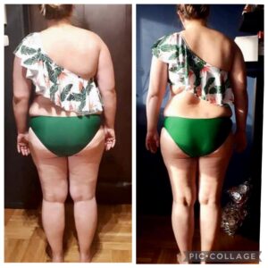 metamorfozy przed i po aplikacja miazga 00196