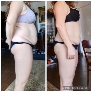 metamorfozy przed i po aplikacja miazga 00201