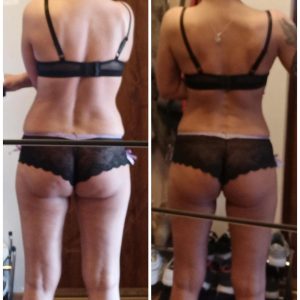 metamorfozy przed i po aplikacja miazga 00204