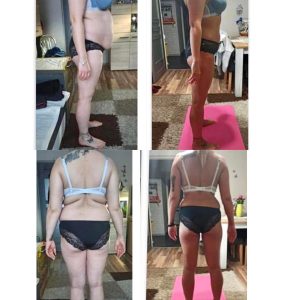 metamorfozy przed i po aplikacja miazga 00207