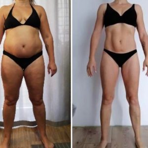 metamorfozy przed i po aplikacja miazga 00208