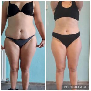 metamorfozy przed i po aplikacja miazga 00213