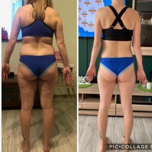 metamorfozy przed i po aplikacja miazga 00221