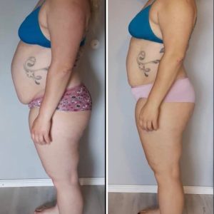 metamorfozy przed i po aplikacja miazga 00222