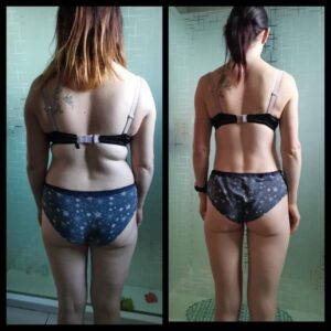 metamorfozy przed i po aplikacja miazga 00225