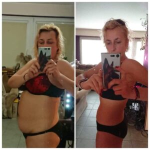 metamorfozy przed i po aplikacja miazga 00226