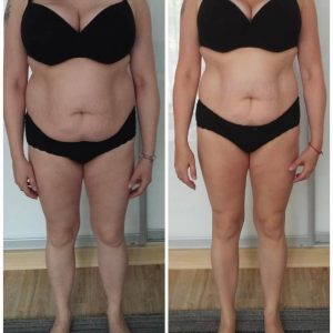 metamorfozy przed i po aplikacja miazga 00229