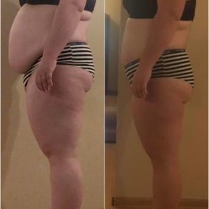 metamorfozy przed i po aplikacja miazga 00230