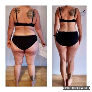 metamorfozy przed i po aplikacja miazga 00232