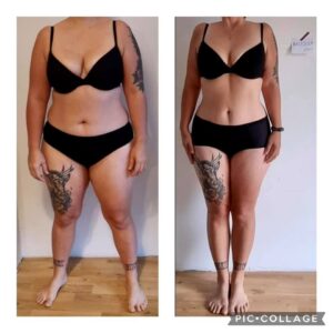 metamorfozy przed i po aplikacja miazga 00233