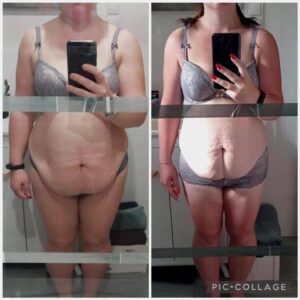 metamorfozy przed i po aplikacja miazga 00234