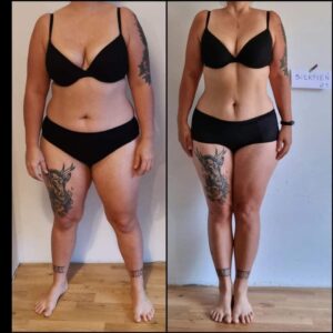 metamorfozy przed i po aplikacja miazga 00237