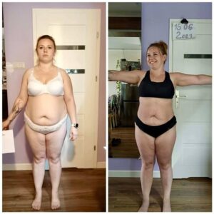 metamorfozy przed i po aplikacja miazga 00241