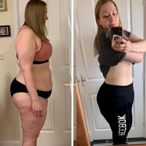 metamorfozy przed i po aplikacja miazga 00243