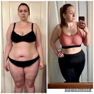 metamorfozy przed i po aplikacja miazga 00244