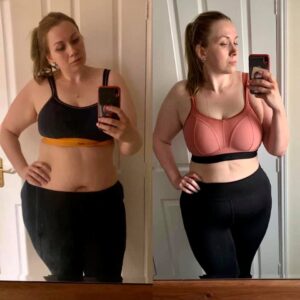 metamorfozy przed i po aplikacja miazga 00245