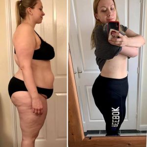 metamorfozy przed i po aplikacja miazga 00246