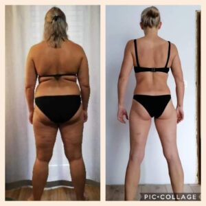 metamorfozy przed i po aplikacja miazga 00247