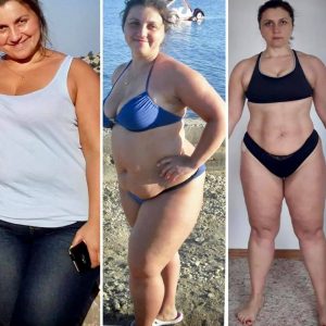 metamorfozy przed i po aplikacja miazga 00249