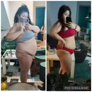 metamorfozy przed i po aplikacja miazga 00251