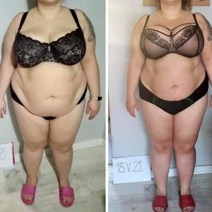 metamorfozy przed i po aplikacja miazga 00252