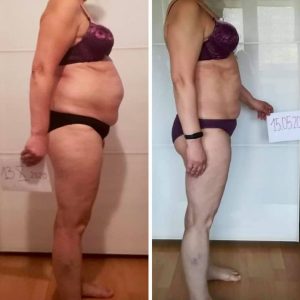 metamorfozy przed i po aplikacja miazga 00253