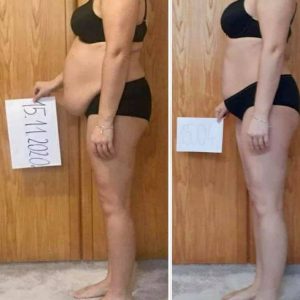 metamorfozy przed i po aplikacja miazga 00254