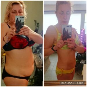 metamorfozy przed i po aplikacja miazga 00262