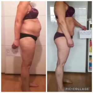 metamorfozy przed i po aplikacja miazga 00263