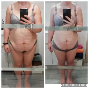 metamorfozy przed i po aplikacja miazga 00264