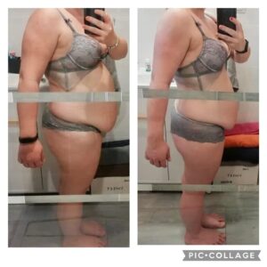 metamorfozy przed i po aplikacja miazga 00265