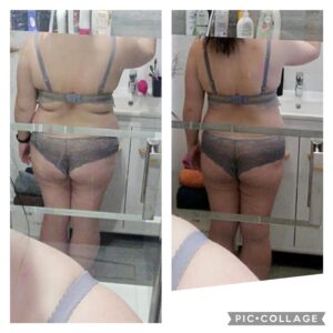 metamorfozy przed i po aplikacja miazga 00266