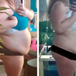 metamorfozy przed i po aplikacja miazga 00267