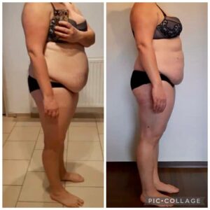 metamorfozy przed i po aplikacja miazga 00268