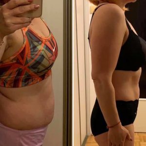 metamorfozy przed i po aplikacja miazga 00269