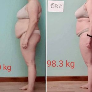 metamorfozy przed i po aplikacja miazga 00270