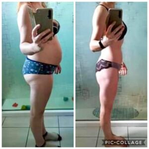 metamorfozy przed i po aplikacja miazga 00271