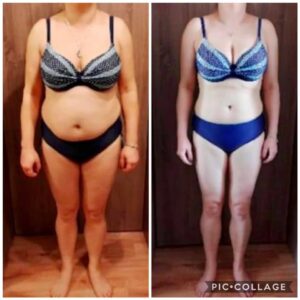 metamorfozy przed i po aplikacja miazga 00272