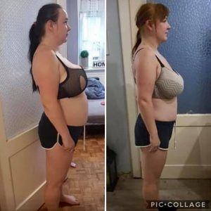 metamorfozy przed i po aplikacja miazga 00274