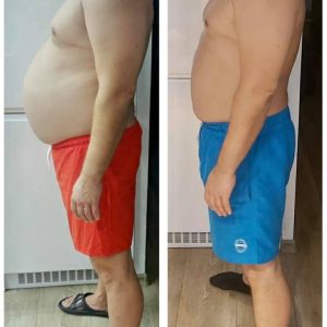 metamorfozy przed i po aplikacja miazga 00275