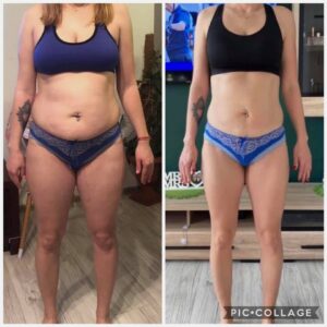 metamorfozy przed i po aplikacja miazga 00277