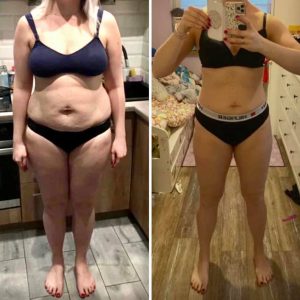 metamorfozy przed i po aplikacja miazga 00278