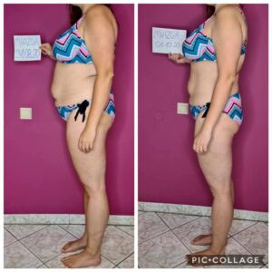 metamorfozy przed i po aplikacja miazga 00282