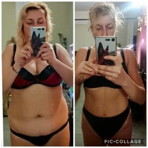 metamorfozy przed i po aplikacja miazga 00284