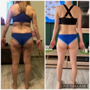 metamorfozy przed i po aplikacja miazga 00285