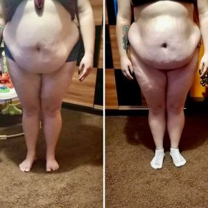 metamorfozy przed i po aplikacja miazga 00286