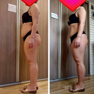 metamorfozy przed i po aplikacja miazga 00288