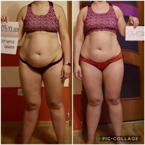 metamorfozy przed i po aplikacja miazga 00289