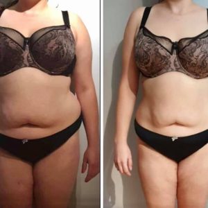 metamorfozy przed i po aplikacja miazga 00290