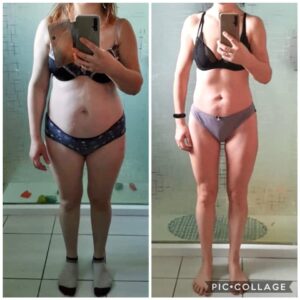 metamorfozy przed i po aplikacja miazga 00294